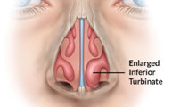 SleepFacts_EckCreativeMedia_Breathing’s Important_Nose
